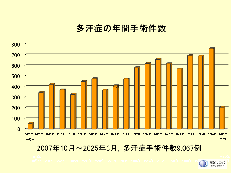 多汗症手術