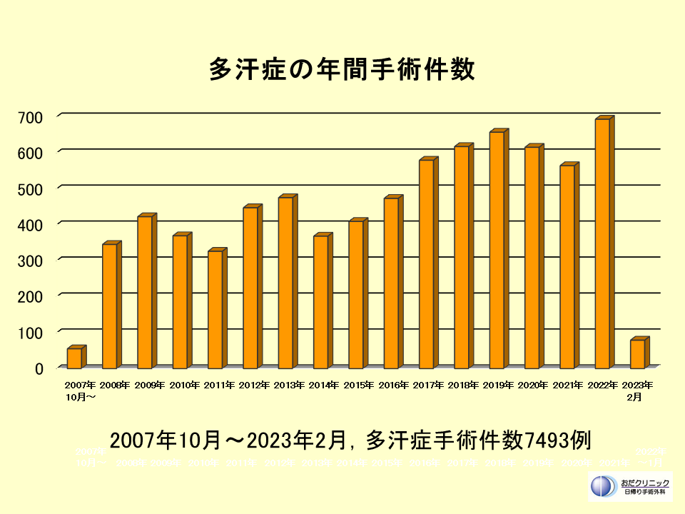 多汗症手術