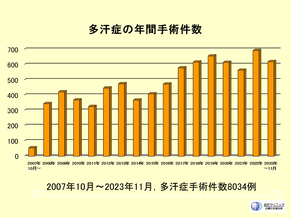 多汗症手術