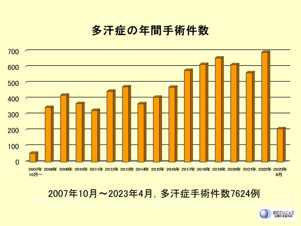 多汗症手術